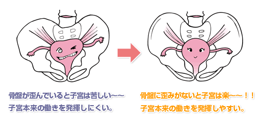 骨盤の歪み