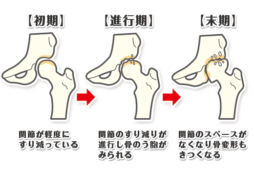 臼 蓋 形成 不全 やってはいけない こと