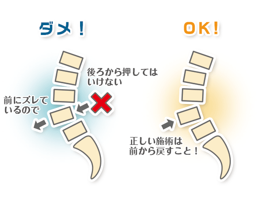 すべり症の施術法