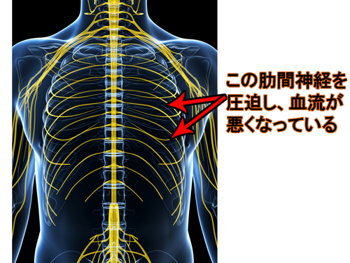 肋間神経痛