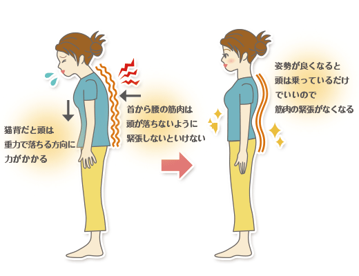 腰痛と姿勢の関係